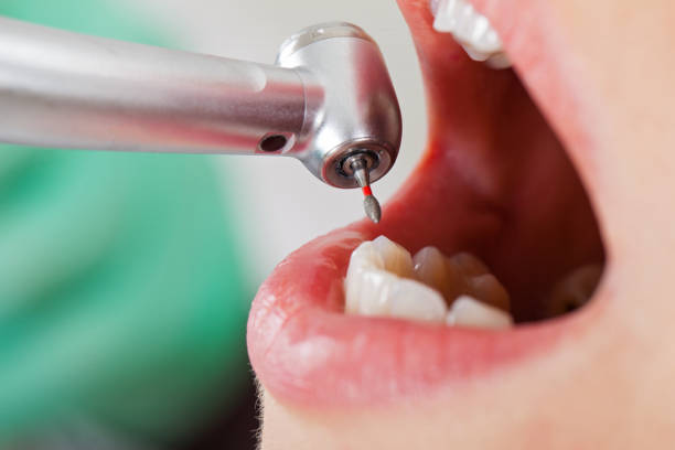 Best Dentist for Dental Trauma  in Okeechobee, FL